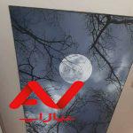 اجرای طرح کشسان با ضمانت کامل